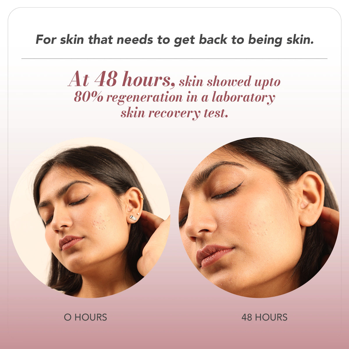 HA MANDELIC FOLLICULAR RENEW 3X